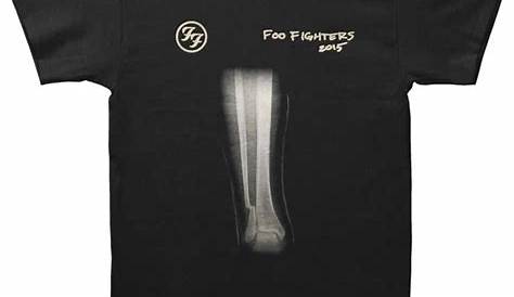 You can now buy a shirt with an x-ray of Dave Grohl's broken leg