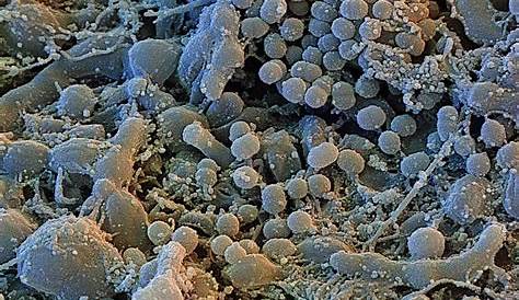 Dental Plaque Under Microscope Science Prose Kissing Transfers 80 Million Bacteria