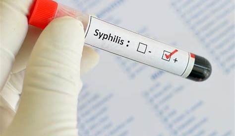 Diagnostic Test For Syphilis Diagnosis Algorithm Usefulness Of New Automated