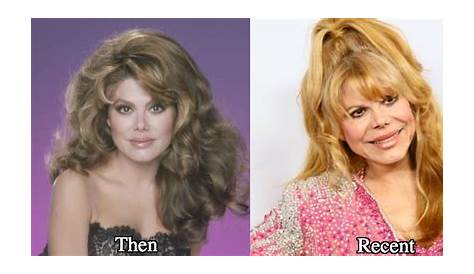 Uncover The Truth: Charo's Nose Job Mystery Explored