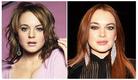 Lindsay Lohan's Facelift: Unveiling The Truth