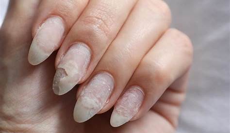 Do Acrylic Nails Cause Permanent Damage s RUIN Your ? Debunking Nail
