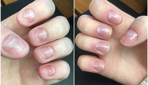 Do Acrylics Ruin Your Nails ? We Asked A Pro