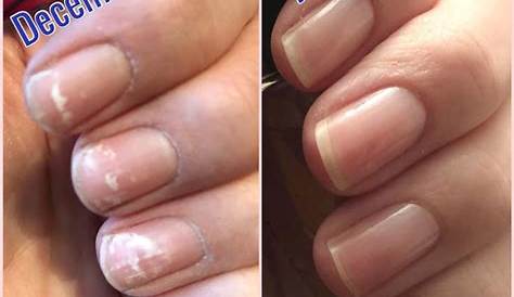 Does Gel Nail Polish Damage Your Nails? 100 PURE