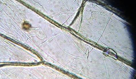 Epidermis de cebolla, células y núcleos, Allium cepa (Liliaceae) - 2157