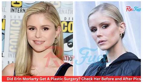 Unveiling The Secrets Of Erin Moriarty's Buccal Fat: Discoveries And Insights