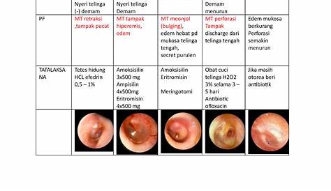 Fase Otitis Media Akut Presentasi Pbl 2 Gangguan Pendengaran Ppt Download