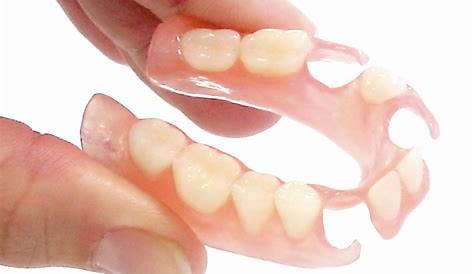 Flexible Partial Dentures Uk Denture Made To Order Custom Teeth