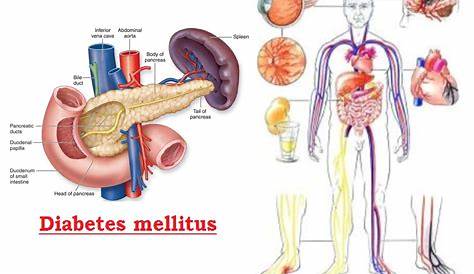 Penyakit Diabetes Melitus: Gejala, Penyebab, Obat, dll.