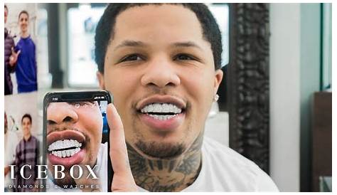 Gervonta Davis' Teeth Gems: Uncovering The Bling And Beyond