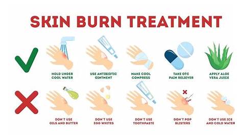 Curious Kids: why don't burns bleed?