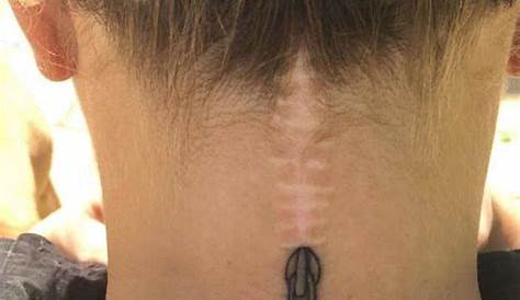 scar tattoo, head tattoo, scar cover up by Jenny Forth | Scar tattoo