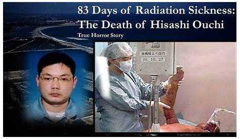 Unveiling The Intriguing World Of Hisashi Radiation: Discoveries And Insights