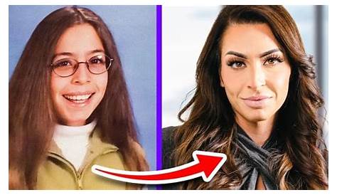 Did Leila Hormozi Receive a Nose Job? Plastic Surgery Details!