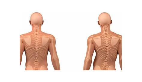 Huesos de la espalda: anatomía y patologías【2020】