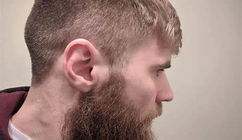 Cauliflower Ear in BJJ: Protect Your Ears and Your Passion - Jiujitsu News