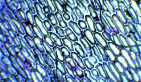 Biologia Celular y Molecular: Epidermis de cebolla