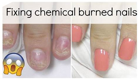 Is Gel X Bad For Your Nails Nail Polh ? Mersi Cosmetics
