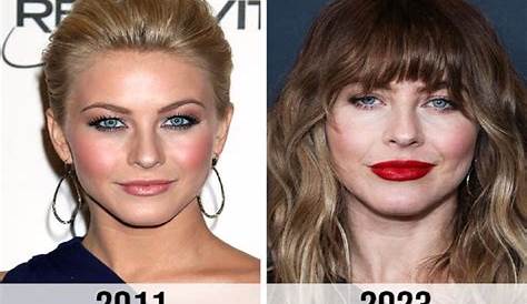 Julianne Hough's Plastic Surgery Transformation: A Journey Of Beauty And Empowerment