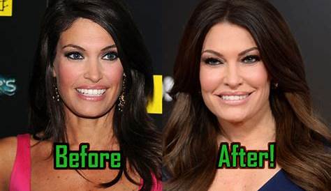 Unveiling Kimberly Guilfoyle's Transformation: Discoveries And Insights