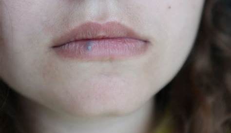 ¿Qué significa tener un LUNAR cerca del labio? - YouTube