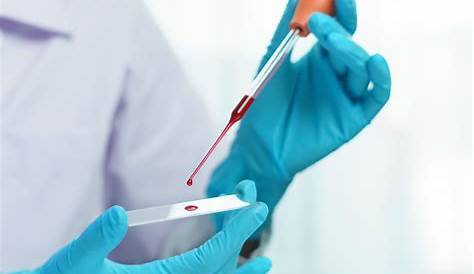 Health Check Up by Blood Diagnosis Concept Stock Photo - Image of