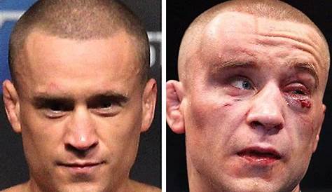 14 of the Most Brutal Before and After Pics of UFC Fighters - Ouch