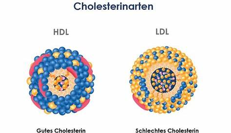 Wodurch werden niedrige HDL-Cholesterinwerte verursacht?