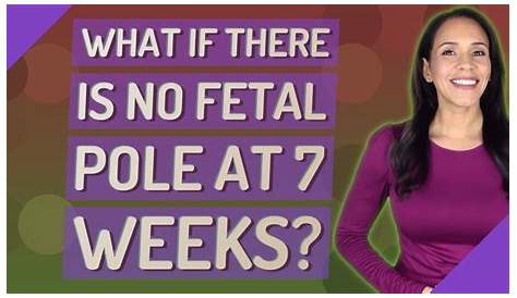 No Yolk Sac, No Fetal Pole on Gestational Sac July 2019 Babies