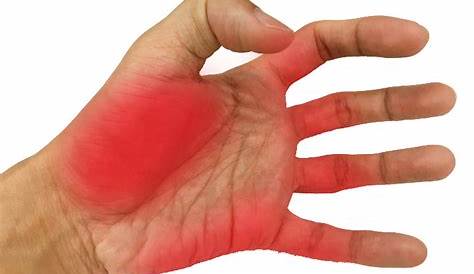 Palmas de las manos rojas: causas