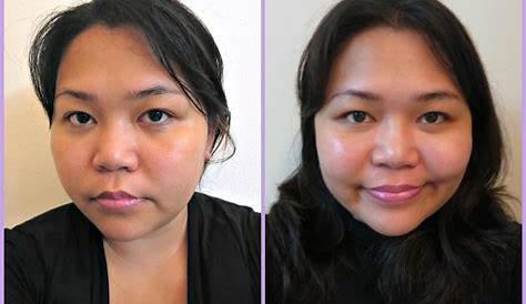 Palmer Skin Therapy Oil Before And After Pictures