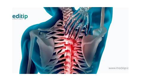 Unidad funcional columna vertebral | Actualizado agosto 2023