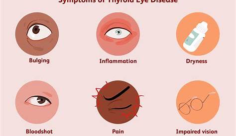 Pictures Of Thyroid Eye Disease