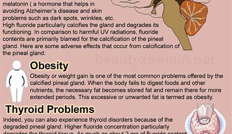 Pineal Gland Calcification Symptoms Signs And Of The