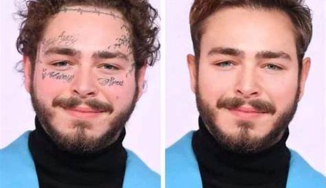 Post Malone Tattoo removal - YouTube