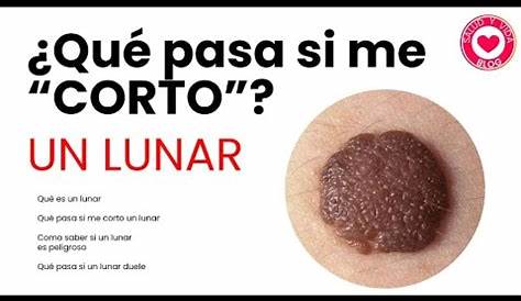 ¿Cómo puedo saber si un lunar, bulto o mancha en la piel es cancerígeno?