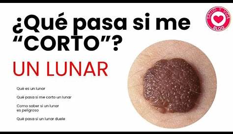 Por qué pican o dan comezón los lunares | Salud180