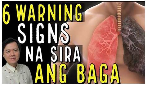 Ano ang mga sintomas ng tubig sa baga - kaalaman
