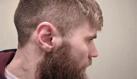 What You Need To Know About Cauliflower Ear In BJJ - Project BJJ