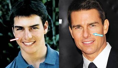 Why does Tom Cruise have the same facial cuts in every movie?