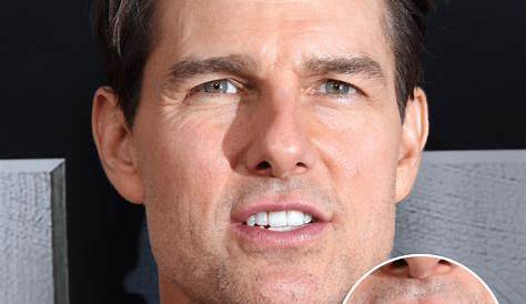 Tom Cruise Middle Tooth and Front Tooth When Smiling