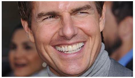 Tom Cruise. | Dental makeover, Celebrity teeth, Celebrity smiles