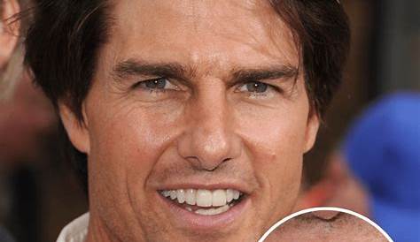 Tom Cruise Teeth and smile - Facts You Need To Know - Plastic Surgery Facts