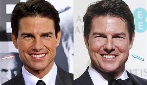 FASHION EXTRA: Tom Cruise Nose Job
