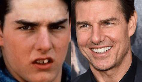 Tom Cruise Has Perfectly Aligned Tooth And It's Weird