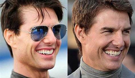 Tom Cruise Nose Job