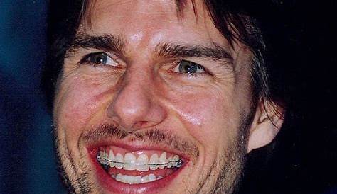 Tom Cruise Middle Tooth Fixed : Tom Cruise Teeth Story Behind Actor S