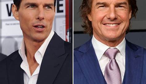 Tom Cruise Plastic Surgery Before and After Pictures 2023
