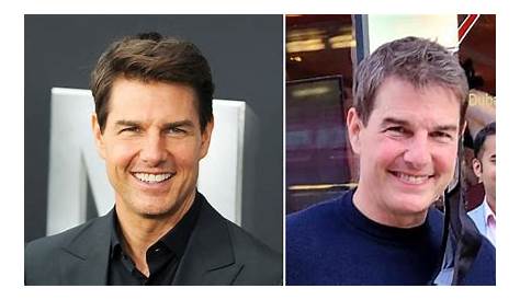 Tom Cruise’s Face Plastic Surgery – Before and After Pictures Sparks