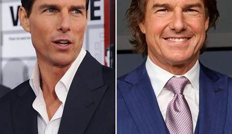 Tom Cruise Plastic Surgery Before and After